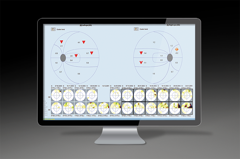 Haag-Streit Octopus 600 Perimeter Basic monitor