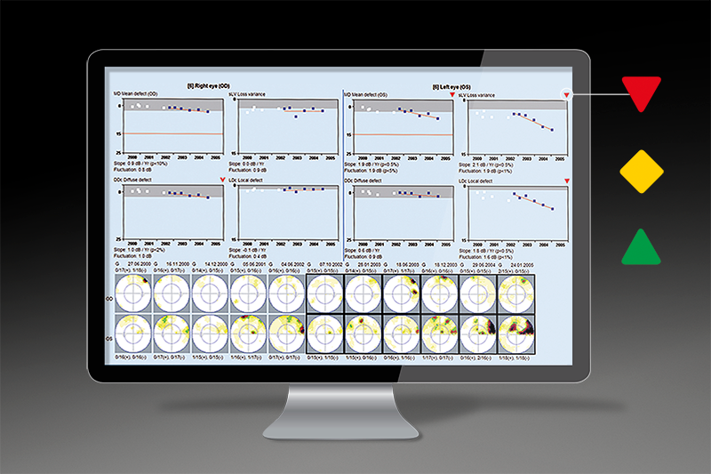 Haag-Streit Octopus 600 Pro Perimeter monitor with report