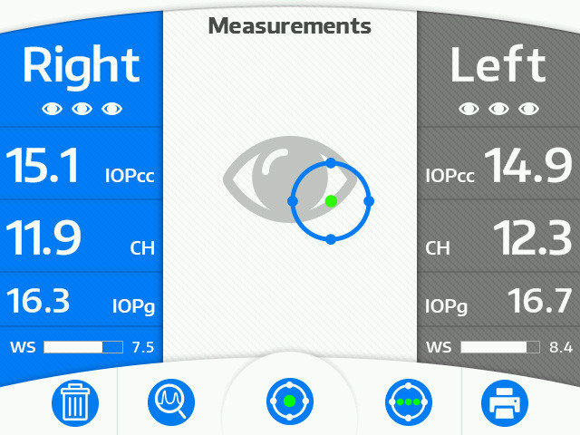 Reichert Ocular Response Analyzer (ORA) G3 screen