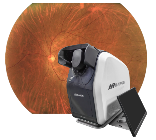 Reticam w Scan Reticam w Scan